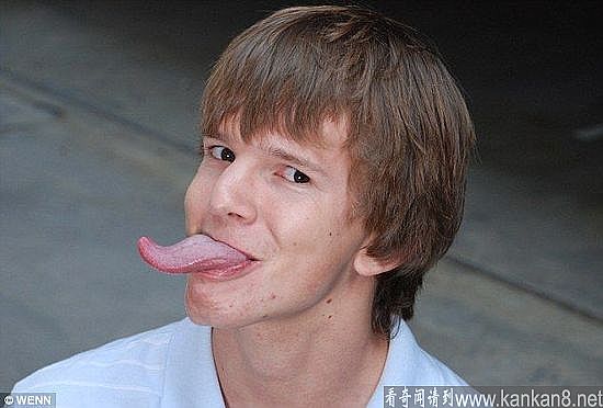 美国青年舌头长9厘米 能扭成麻花状