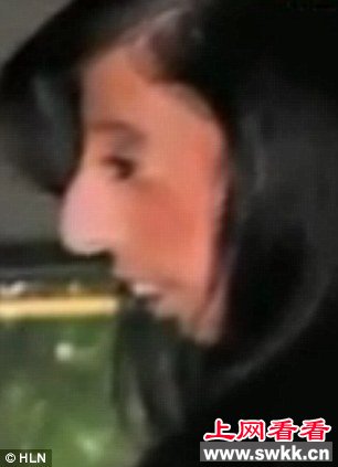 世界上最丑陋的女人：天生缺乏脂肪 体重仅26公斤