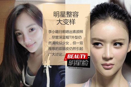 李小璐整容前后清纯变性感 组图