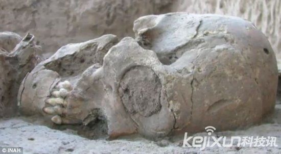 墨西哥惊现“外星人头骨” ：颅骨变形而细长