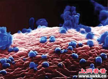 日本教授造超级病毒可绕过人类免疫系统 