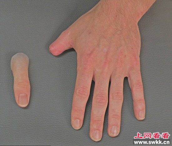 德国硅胶制精致假肢以假乱真 组图