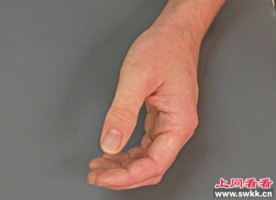 德国硅胶制精致假肢以假乱真 组图