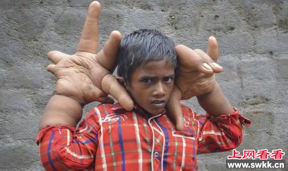 6290303315554749685