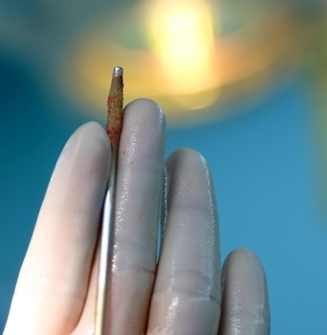 男子为求快感自慰将钢钉插尿道 图