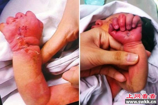 食人族妈妈试图把自己出生后不久的婴儿吃掉
