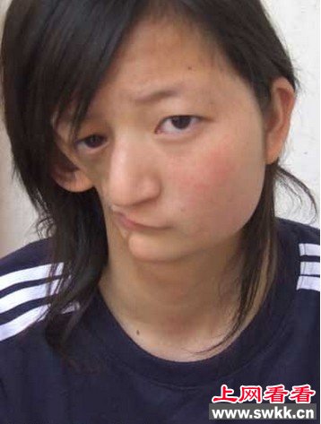 半脸人,怪病