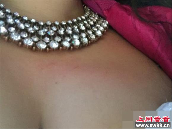 晶女郎孟瑶拍戏摔倒胸着地 欲为36F胸部买保险