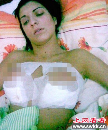 罗马尼亚女主播花3万隆胸致大小不一