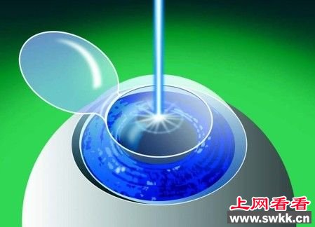 因手术失败德国男孩意外看见了平行世界