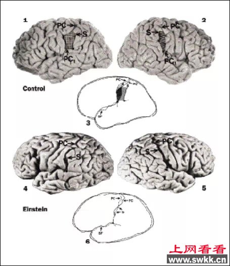 爱因斯坦的智商,爱因斯坦的大脑