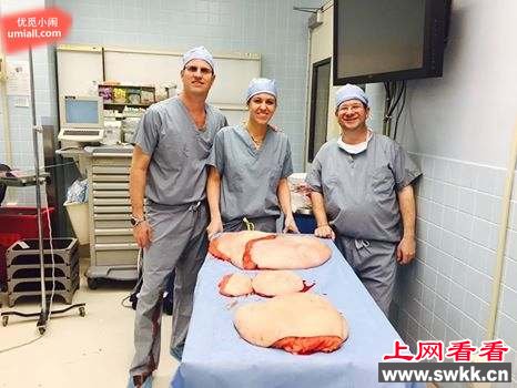 445公斤的世界最胖男子瘦身成功