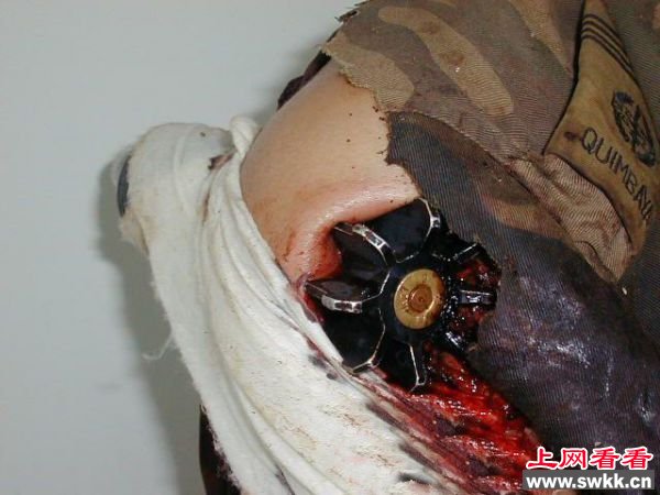 血腥恐怖分子肩被炮弹击穿捡回一条小命