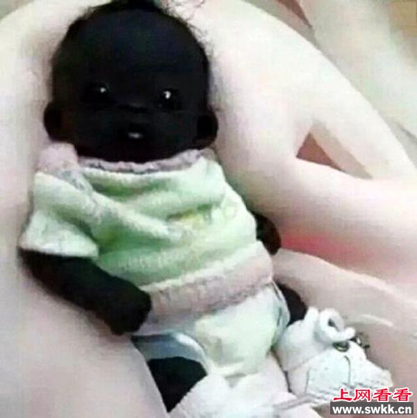 世界上最黑的孩子