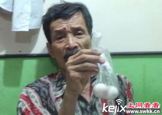 奇闻：印尼62岁男子四次生蛋 专家称不可能