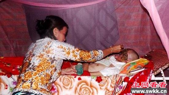 男子术后容貌尽毁