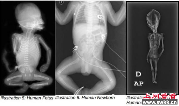 10年前智利发现的“外星人”骸骨实为突变人类