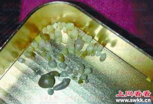 买生蚝吃出珍珠 细数那些吃出的意外之财（图）