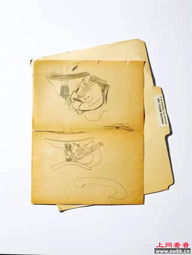 他偷走了爱因斯坦的大脑，可什么也没研究出来