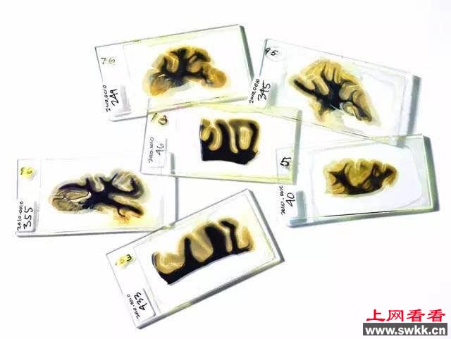 他偷走了爱因斯坦的大脑，可什么也没研究出来