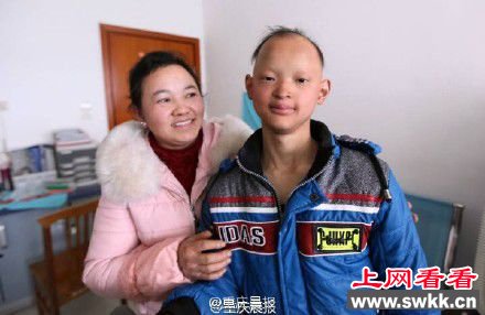 男孩患怪病酷似”吸血鬼“