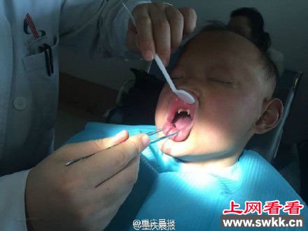 男孩患怪病酷似”吸血鬼“