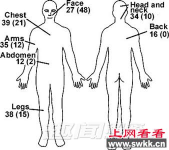 橡胶子弹