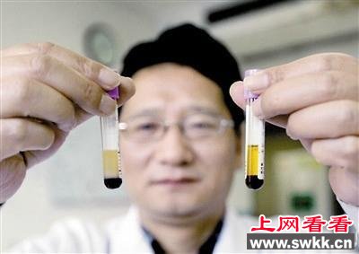 4岁男孩抽血呈乳白色 医生诊断为白血病(图)