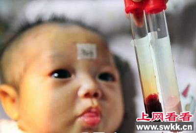 4岁男孩抽血呈乳白色 医生诊断为白血病(图)