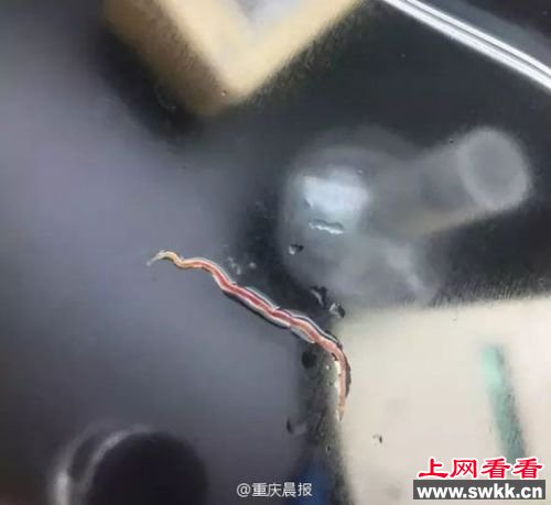 女子咳嗽居然咳嗽咳出6条活虫