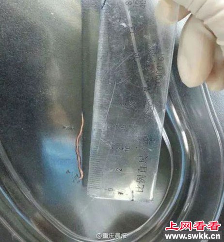 女子咳嗽居然咳嗽咳出6条活虫 www.swkk.com