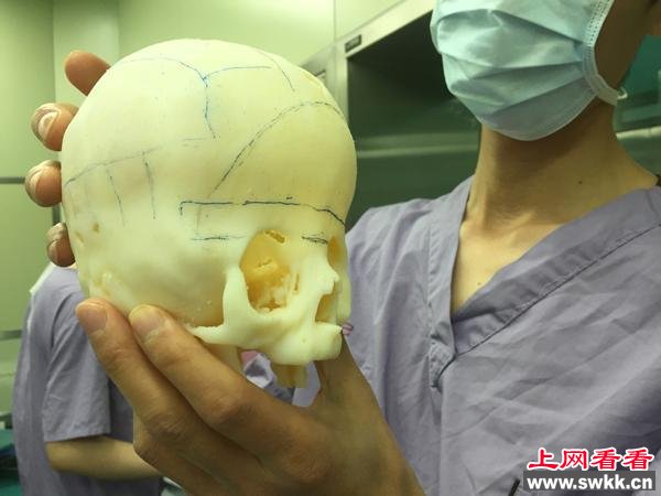 8月大的男婴颅骨似外星人 图