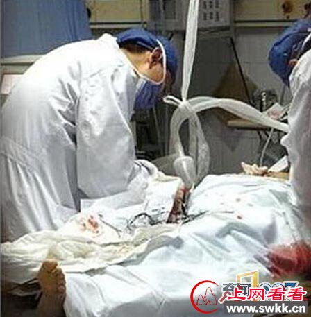 阳具自燃变焦炭！河南男子运动时下体着火竟烧伤女友