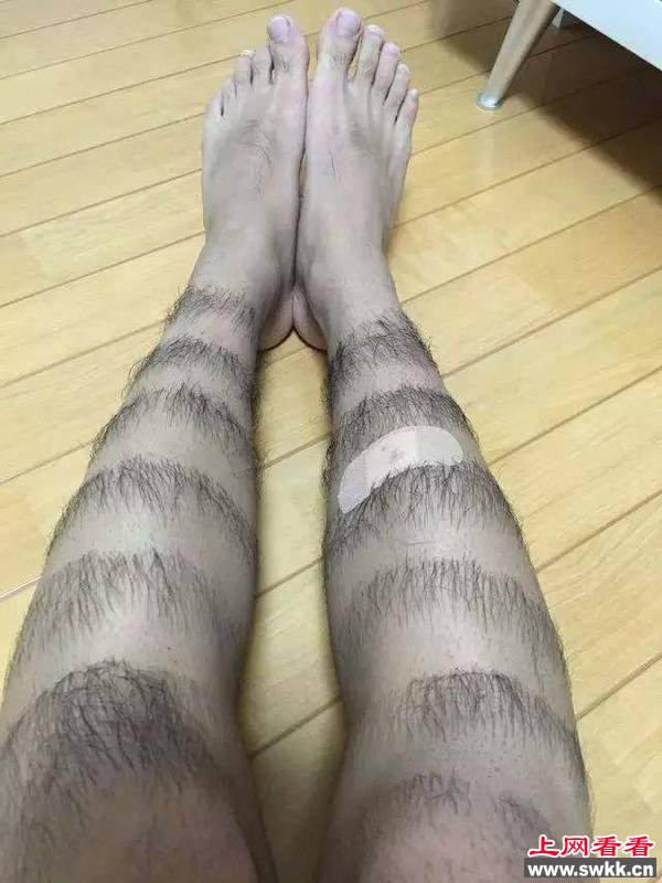男生前卫腿毛爆红