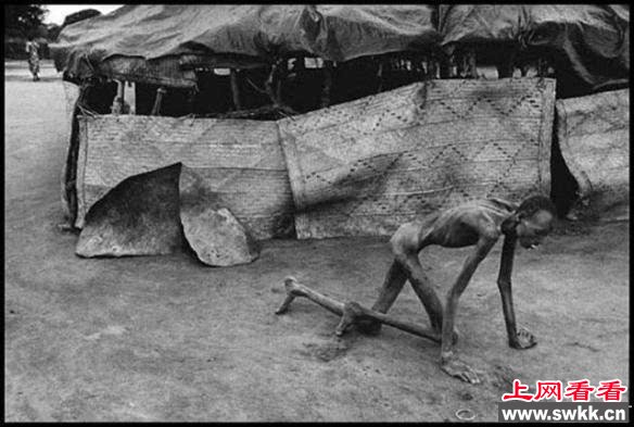 这张震撼人心的照片由《时代》杂志的摄影师詹姆斯·纳赫特韦（James Nachtwey，当今世界最广为人知也是最受赞誉的战地摄影师之一）于1993年拍摄，照片中的男人位于南苏丹的食物中枢，却因饥饿连站立都困难，正濒临死亡的边缘。