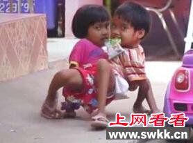 泰国连体姐妹，两人共用一双腿