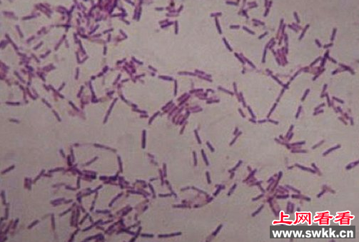 细菌在大多数人眼里都是唯恐避之不及的，而且细菌常常与疾病流感联系在一起，而最近突然出现的350万年前的细菌才真是让人跌破眼镜，多亏了战斗民族，让上帝藏在他西伯利亚大冰箱里的又一件实验品得见天日。下面就跟着奇闻网的小编一起来看看350万年前的细菌的真面目吧。