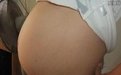 10岁女孩怀孕生娃