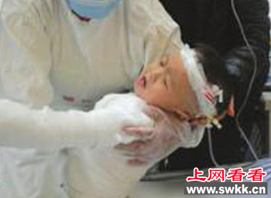 2岁男孩掉进汤锅