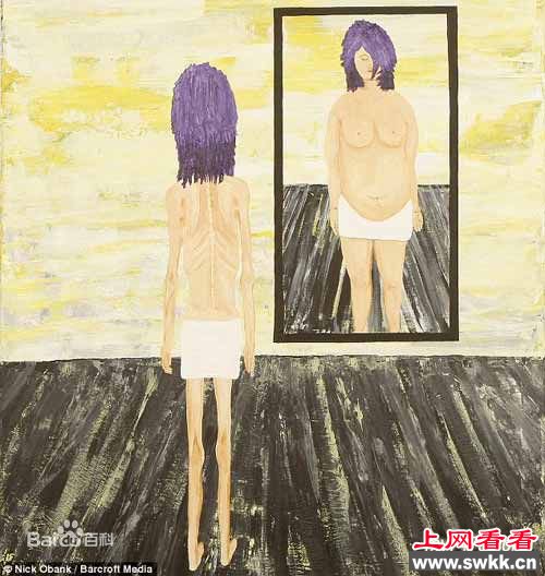 多重人格障碍