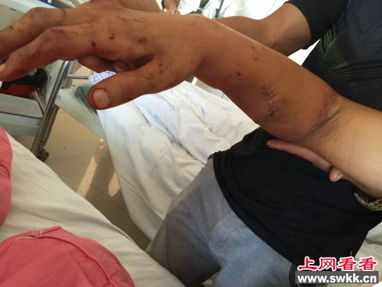 高三班长疑因未组织送礼被老师毒打