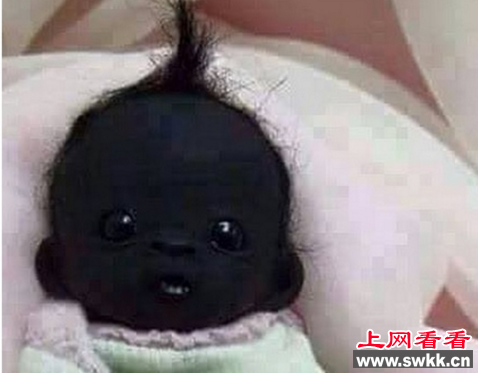 世界最黑的婴儿