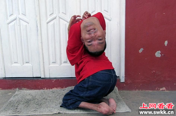 最恐怖的怪病