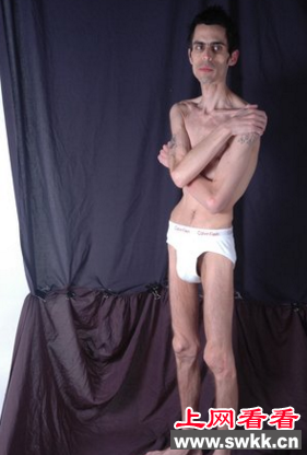 世界最瘦男人