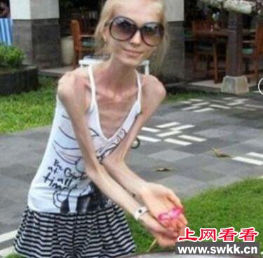 全世界最瘦女人