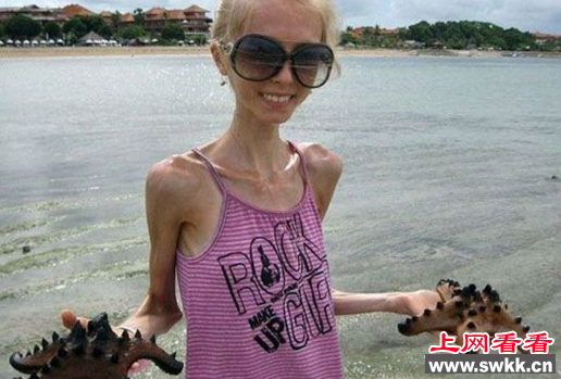瘦到皮包骨头的女人