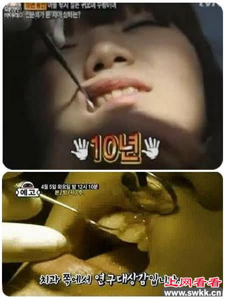 美少女十年没刷牙