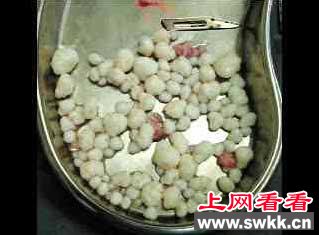 男子肩膀长珍珠