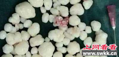 男子肩膀长珍珠