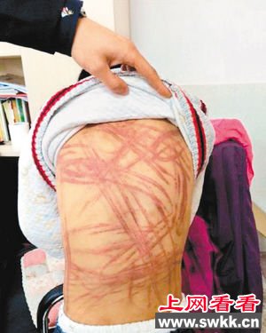 南京养父母虐待男童